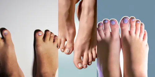 Feet generated by dalle